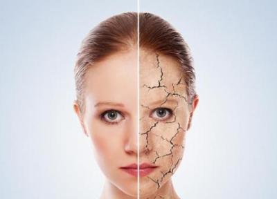 راهنمای کامل درمان و رفع خشکی پوست صورت و بدن